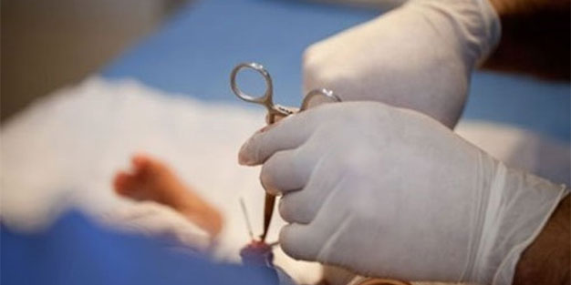 circumcision facts pros cons and risks